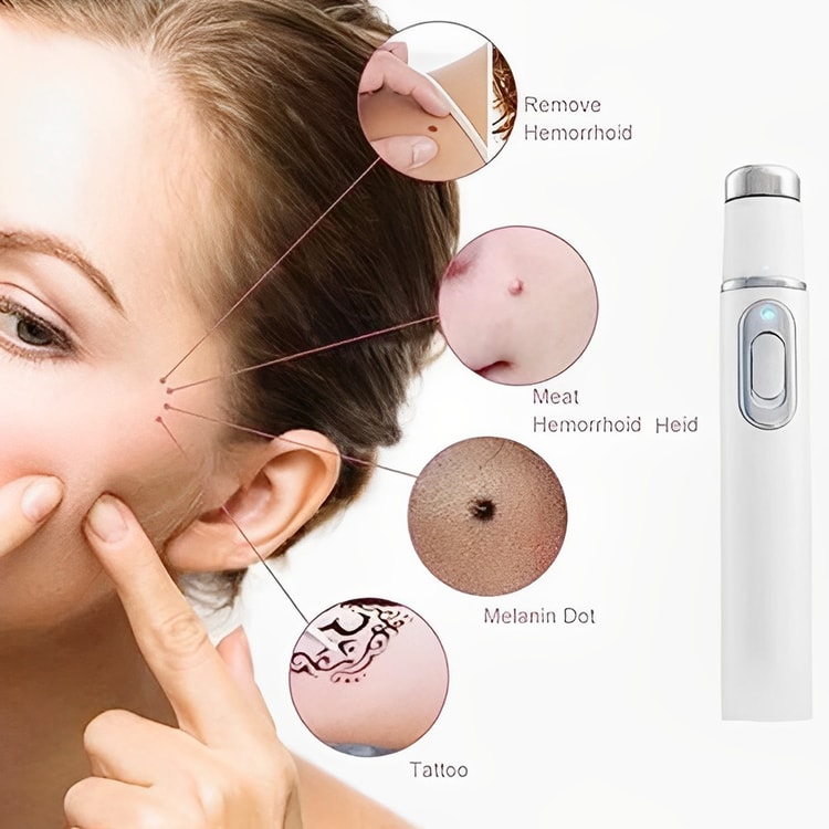 Innovative Anti-Fungal Laser Pen with Cutting-Edge Fungal Infections Removal and Safe-for-Skin Technology