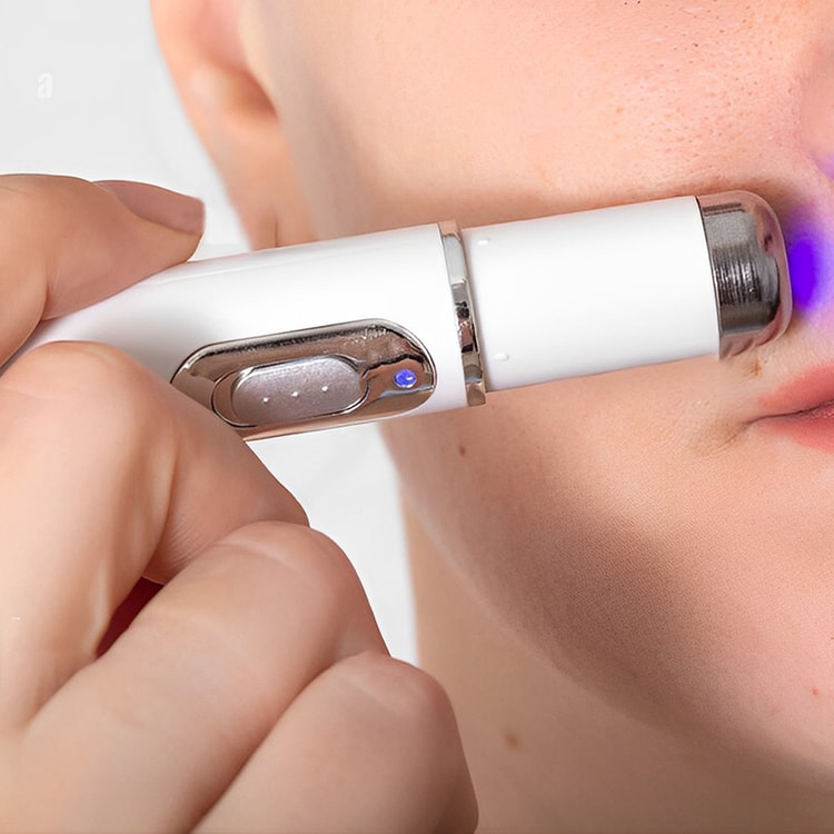Innovative Anti-Fungal Laser Pen with Cutting-Edge Fungal Infections Removal and Safe-for-Skin Technology